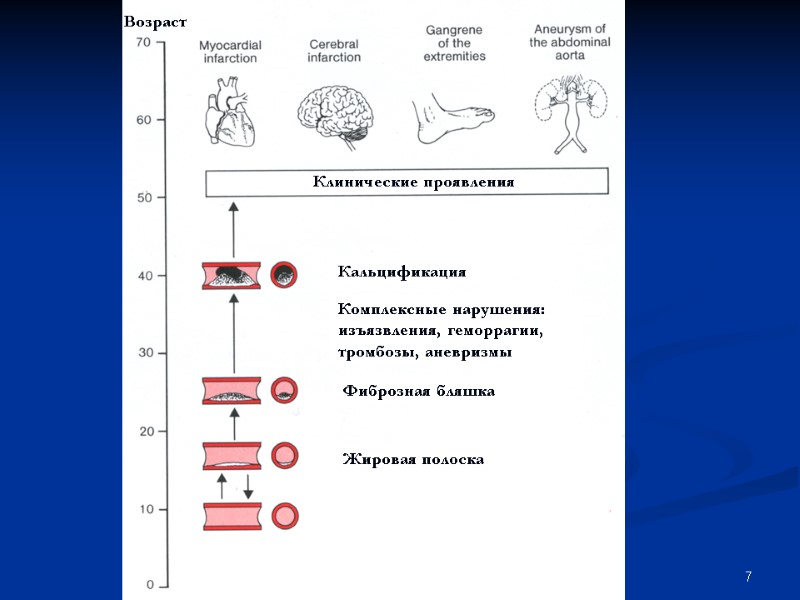 7 Возраст Жировая полоска Фиброзная бляшка Комплексные нарушения: изъязвления, геморрагии, тромбозы, аневризмы Кальцификация Клинические